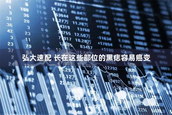 弘大速配 长在这些部位的黑痣容易癌变